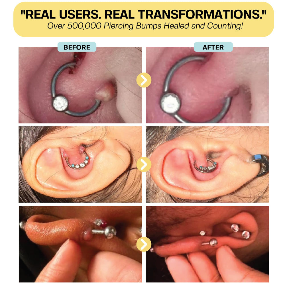 BASE LABORATORIES Zone traitée – bosses et cicatrices sur nez et oreilles