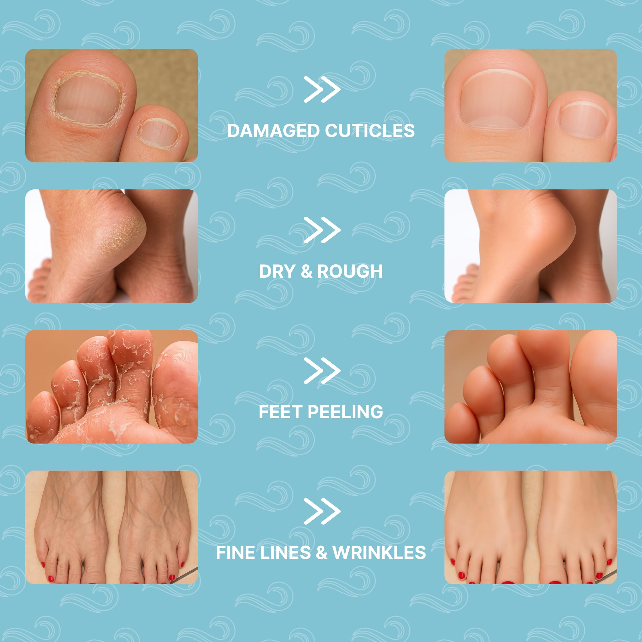 Bayside chaussettes-masque-pieds exfoliant adoucissant les zones sèches.