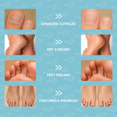 Bayside chaussettes-masque-pieds exfoliant adoucissant les zones sèches.