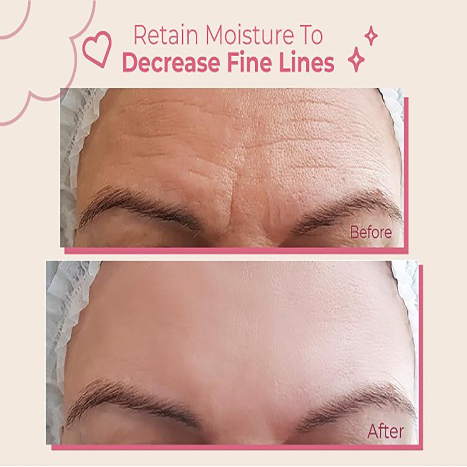 Bayside Forehead Patch application showing easy, discreet wrinkle smoothing.