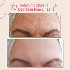 Bayside Forehead Patch application showing easy, discreet wrinkle smoothing.