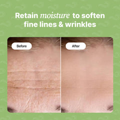 Patchs frontaux Bayside, détail texture hypoallergénique pour peau sensible.