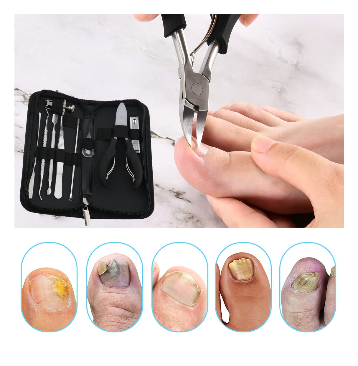 Bcabo coupe-ongles incarné: coupe nette et précise de l’ongle