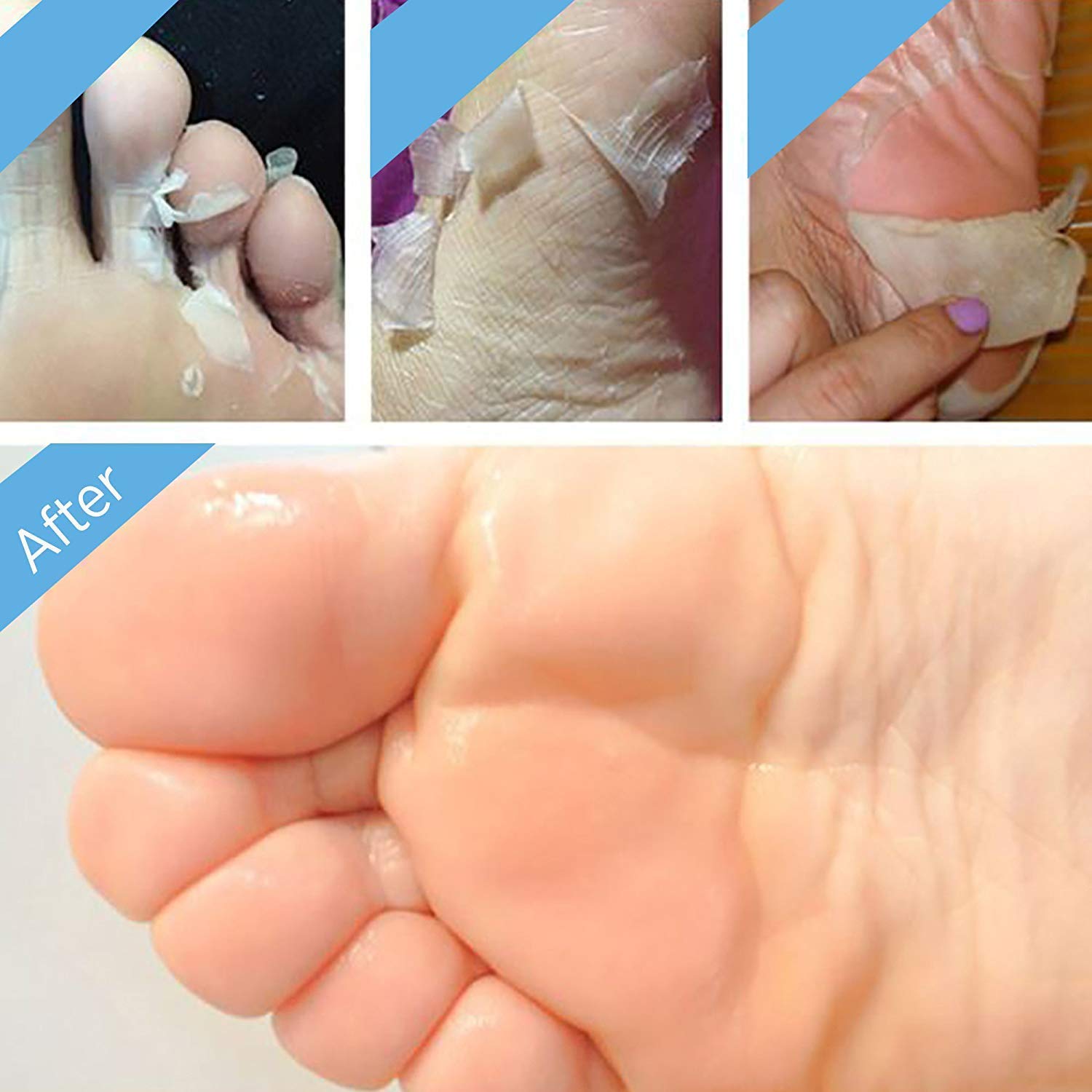 Bealuz avant et après exfoliation pieds résultats visibles