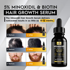 Beaueli Minoxidil pipette doseuse facilitant l’application précise sur cuir chevelu.