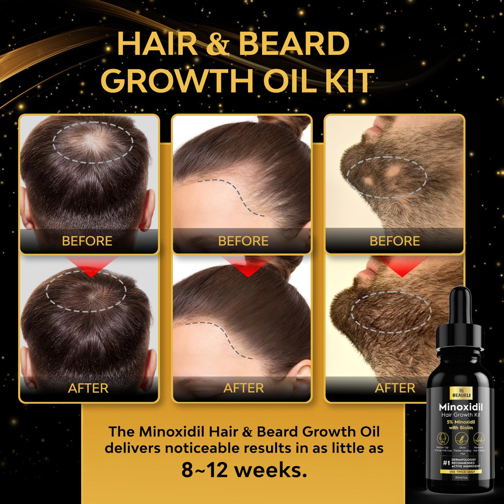 Beaueli Sérum Minoxidil flacon pipette, application précise pour la pousse des poils.