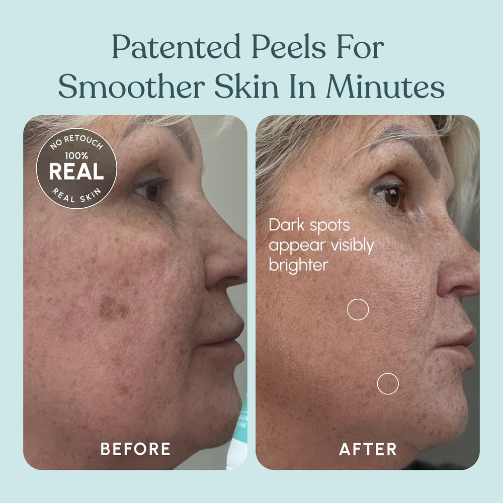 Beautiste éclat immédiat: teint plus lumineux après utilisation.