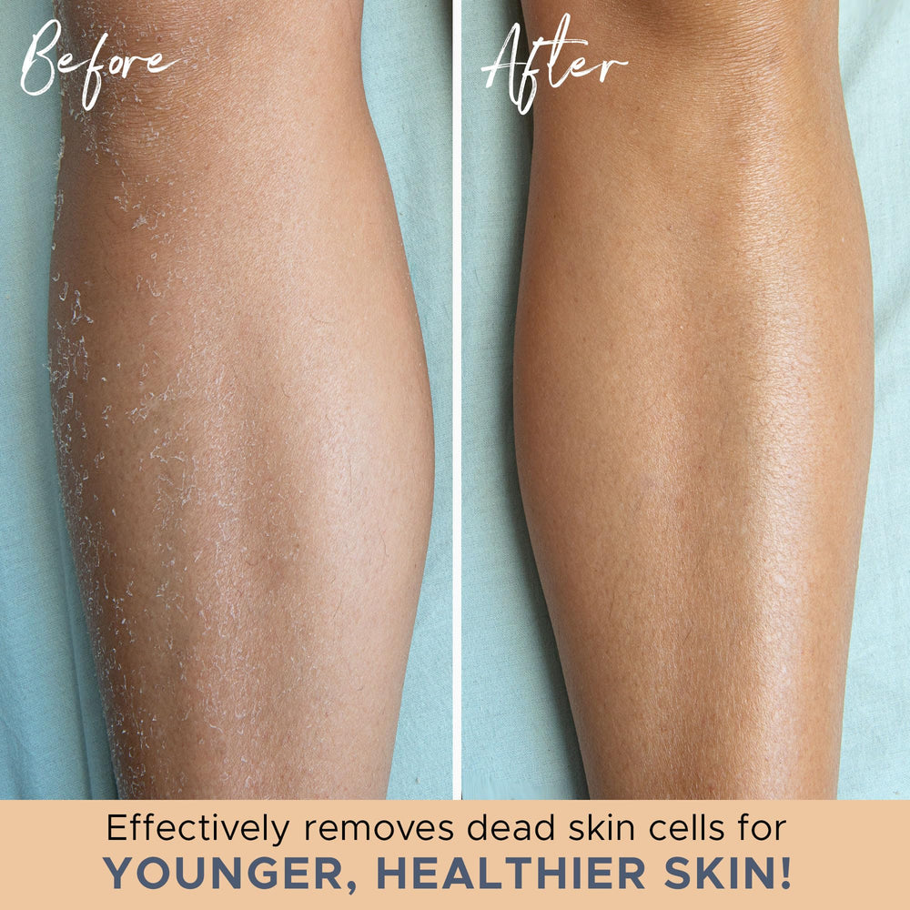 Beauty by Earth gant exfoliant sous la douche pour éliminer les cellules mortes en douceur