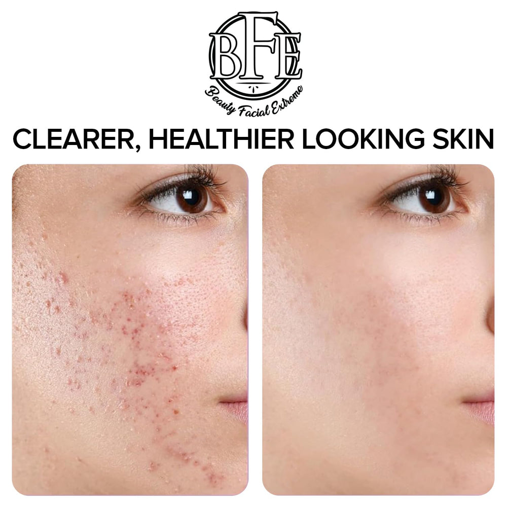 Beauty Facial Extreme – exfoliation immédiate et sensation de fraîcheur