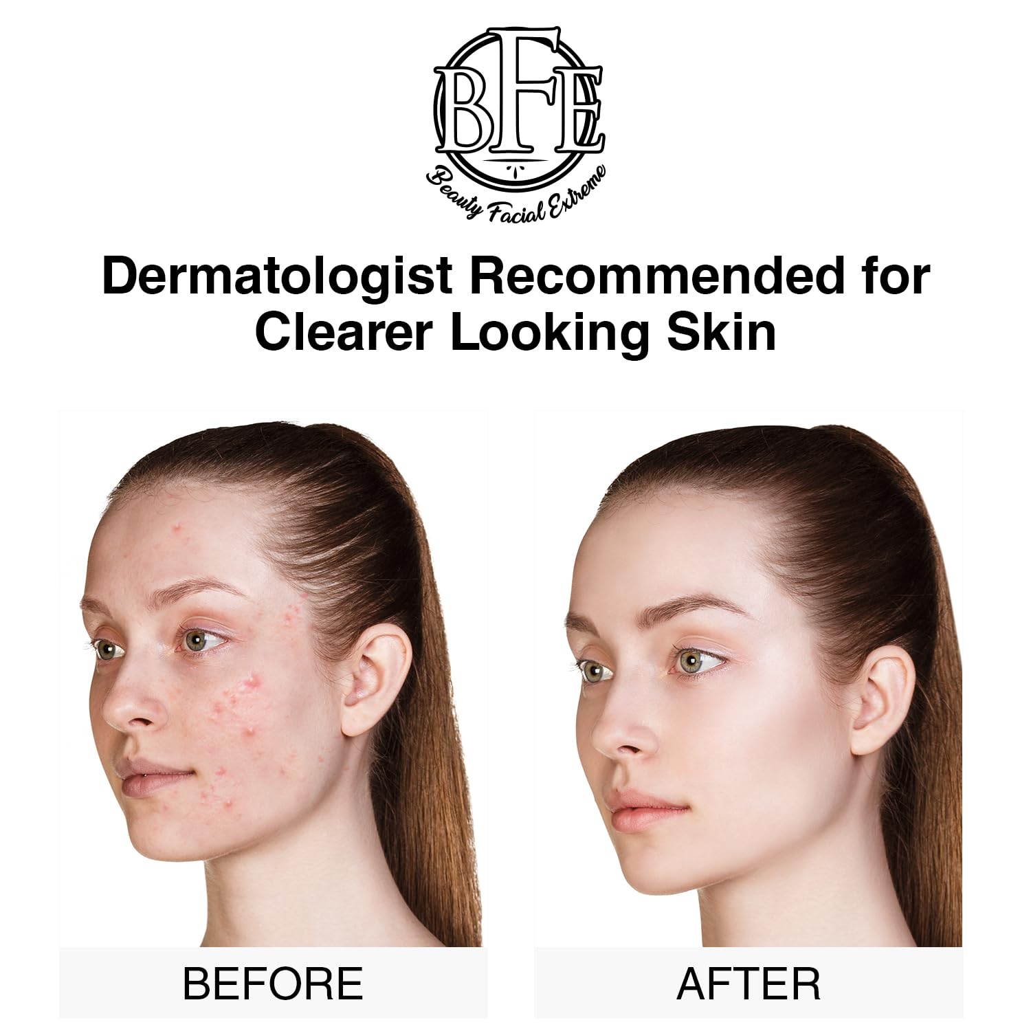 Beauty Facial Extreme – application rapide pour peau nette et équilibrée