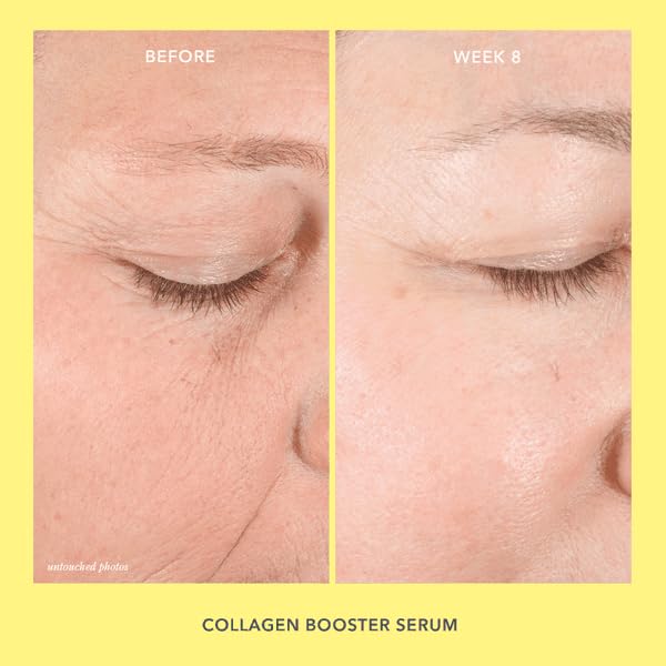 Beekman 1802 sérum visage: formulation non irritante pour peaux sensibles.