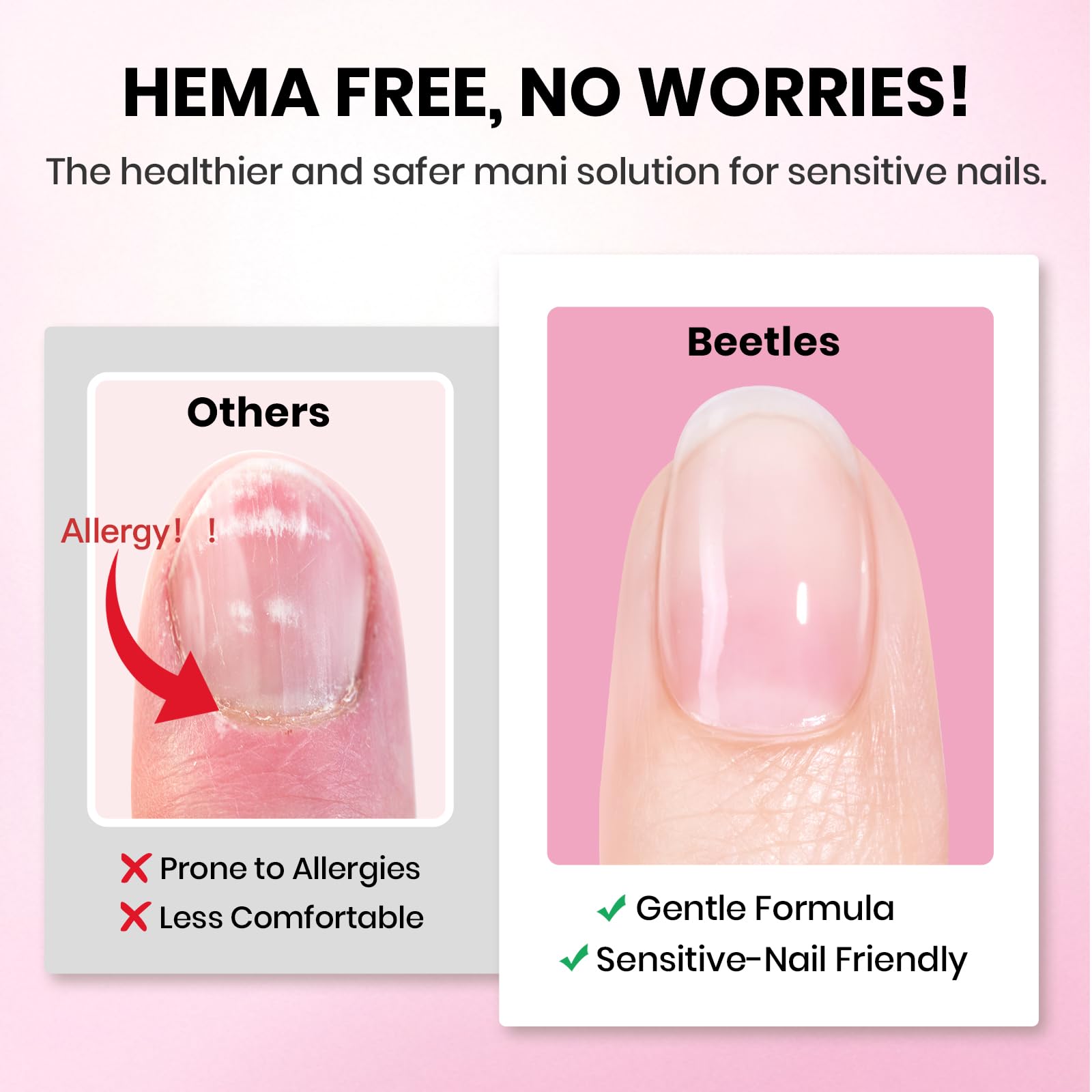 Beetles Etch-X colle gel 15ml, fixation fiable.