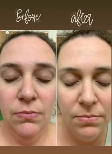 Application du masque Hello Glow sur le visage pour une sensation rafraîchissante