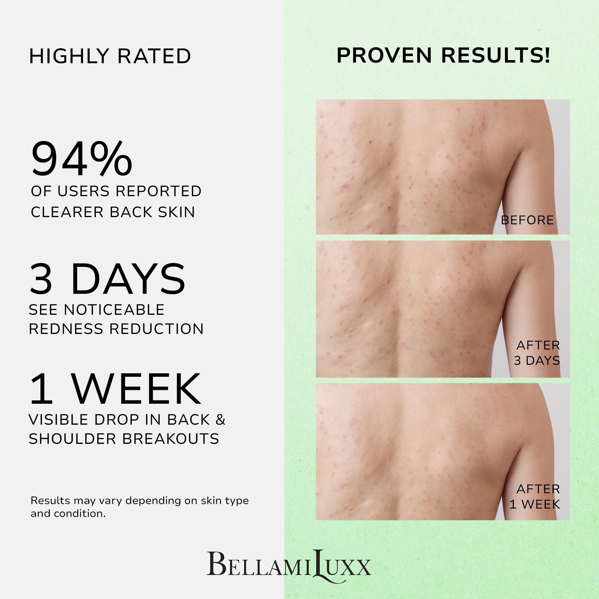 BellamiLuxx Bacne Spray Brume Fin: application uniforme sur le torse et les épaules.