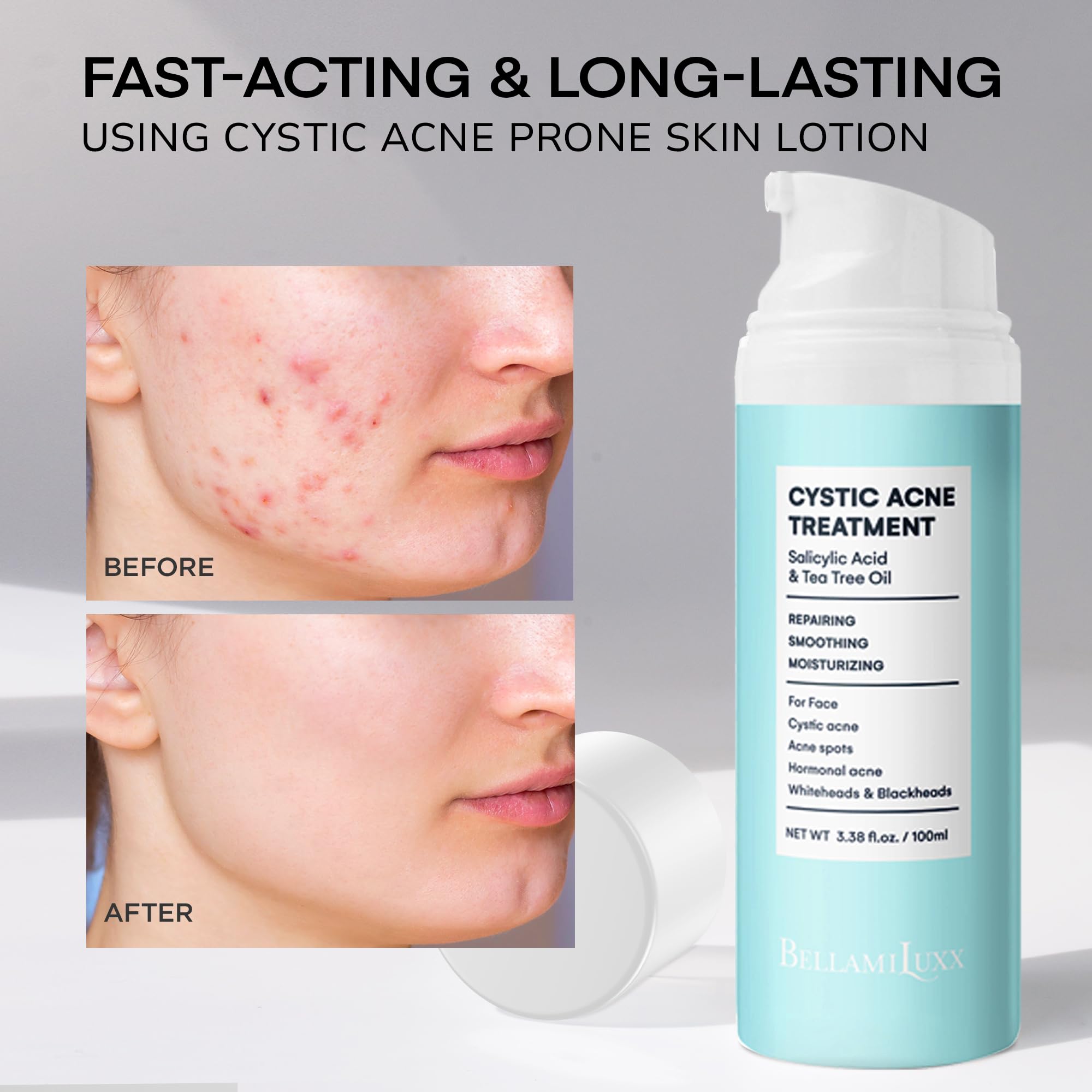 BellamiLuxx huile arbre à thé, formulation naturelle pour calmer irritations.