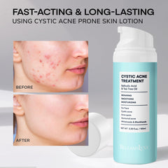 BellamiLuxx huile arbre à thé, formulation naturelle pour calmer irritations.