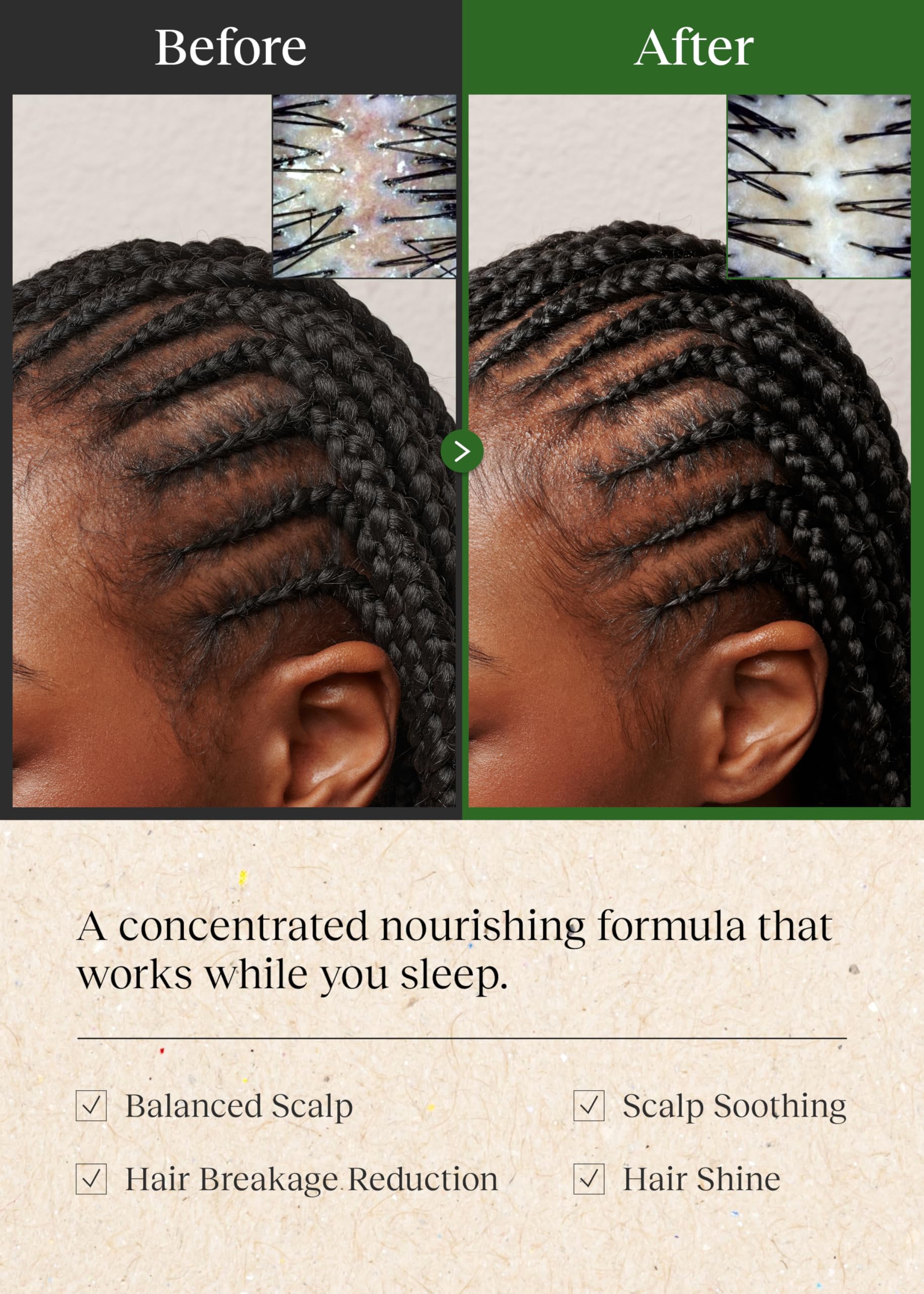 Bephor Braid Rev: massage du cuir chevelu pour absorption uniforme