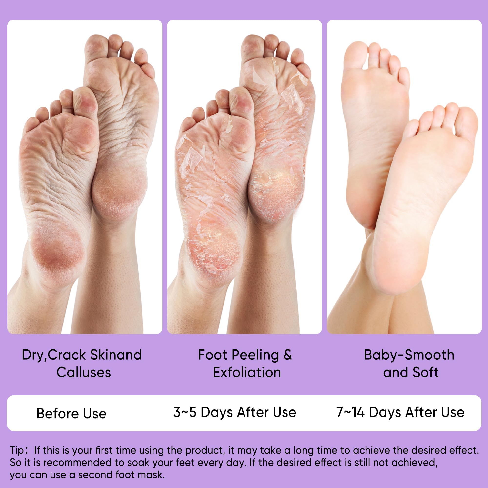Berlaney masque-pieds-format-universel: adapté à toutes les tailles pour une utilisation pratique.