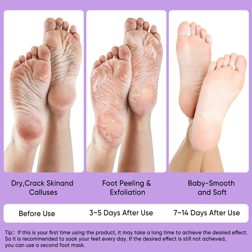 Berlaney masque-pieds-format-universel: adapté à toutes les tailles pour une utilisation pratique.
