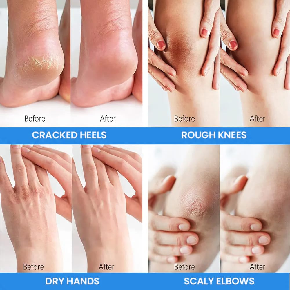 Formulation hypoallergénique et sans fragrance pour soins quotidiens des pieds