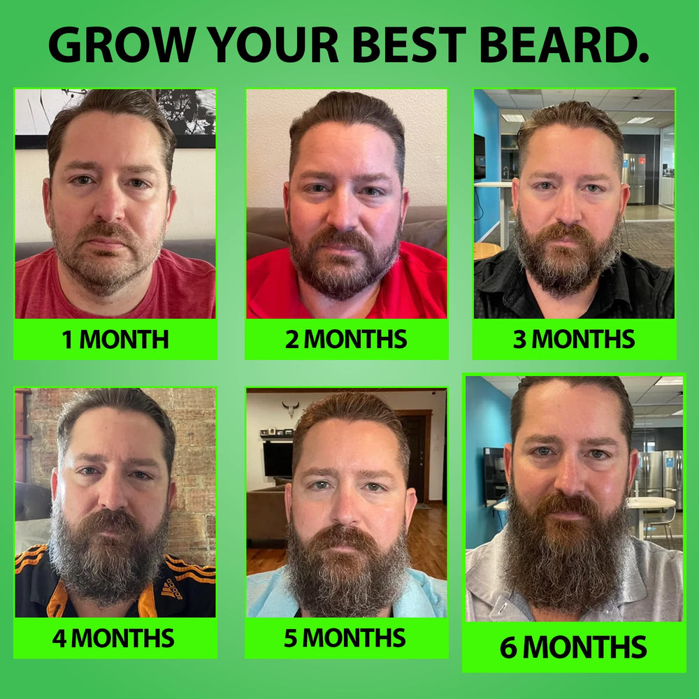 Best Beard Stuff — emballage du kit, présentation pratique et claire