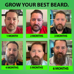 Best Beard Stuff — emballage du kit, présentation pratique et claire