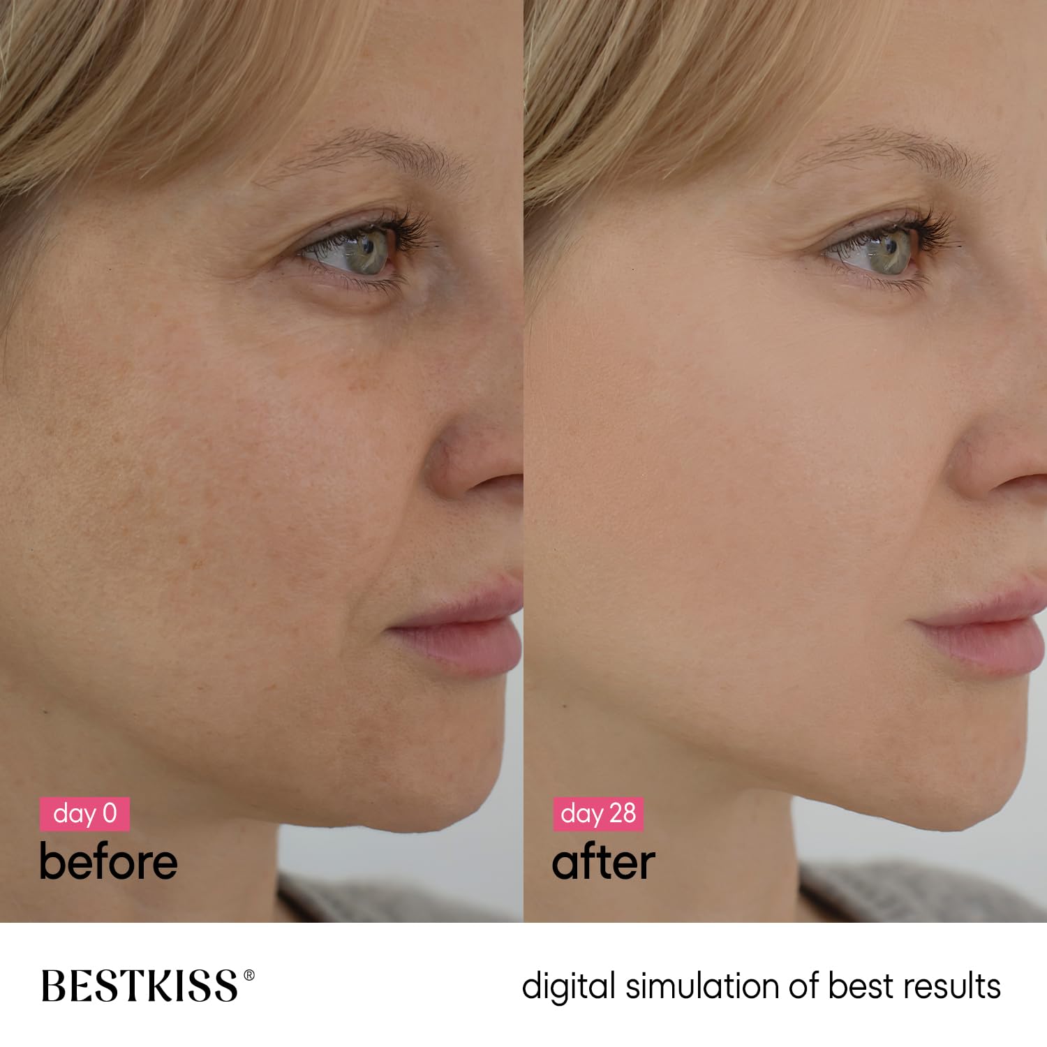 Bestkiss sérum, hyaluronique et Centella apaise et hydrate la peau
