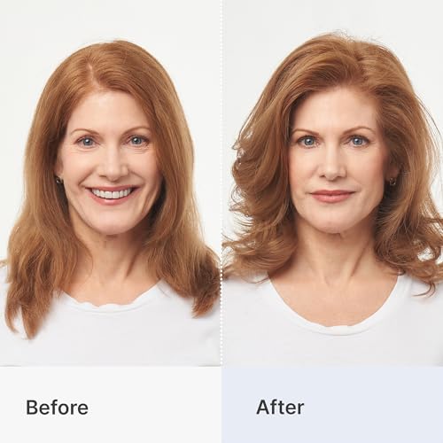 Better Not Younger Biotin-Céramide Stimulation Follicules pour cheveux plus forts