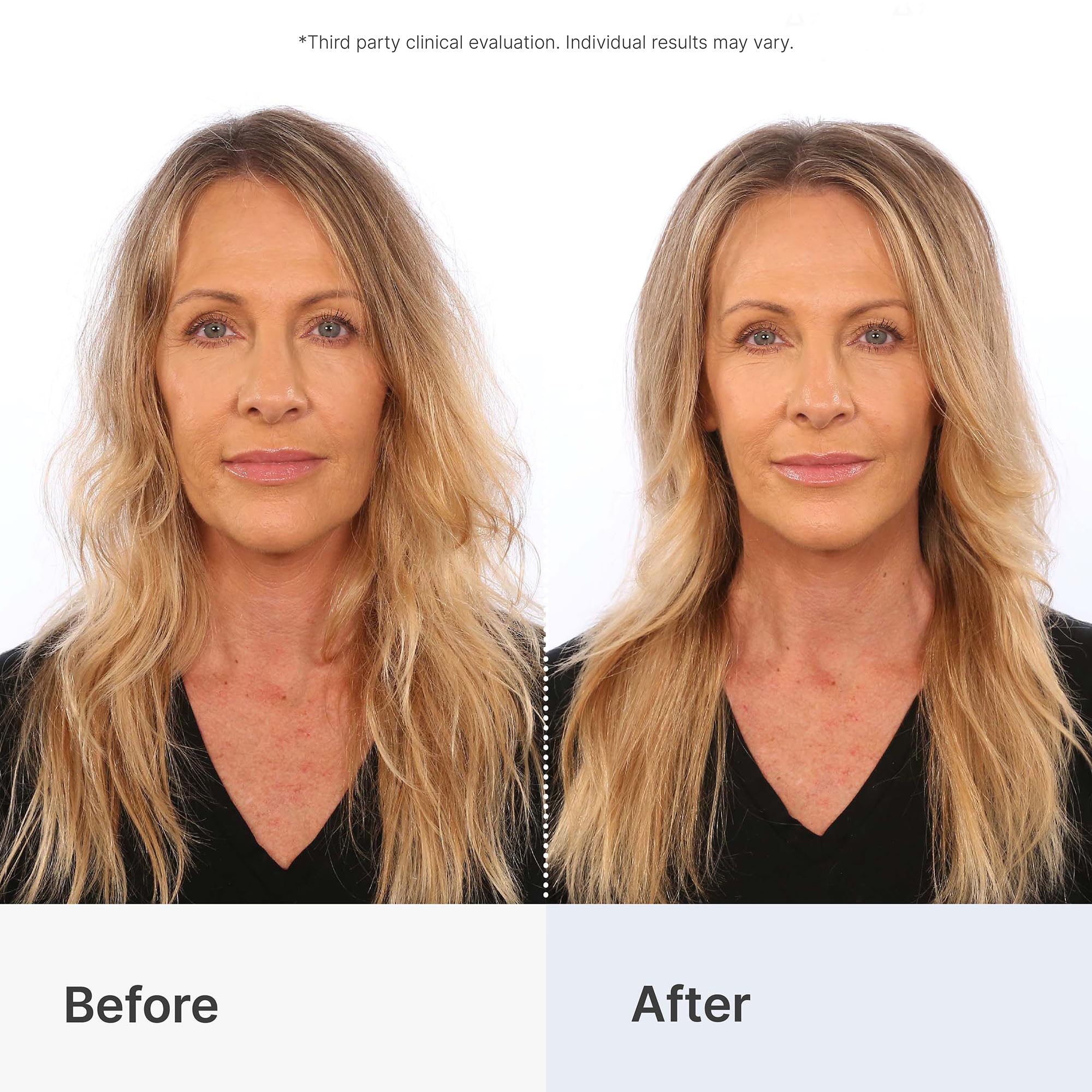 Better Not Younger – formulation nourrissante avec Biotine et Bambou pour densité capillaire.