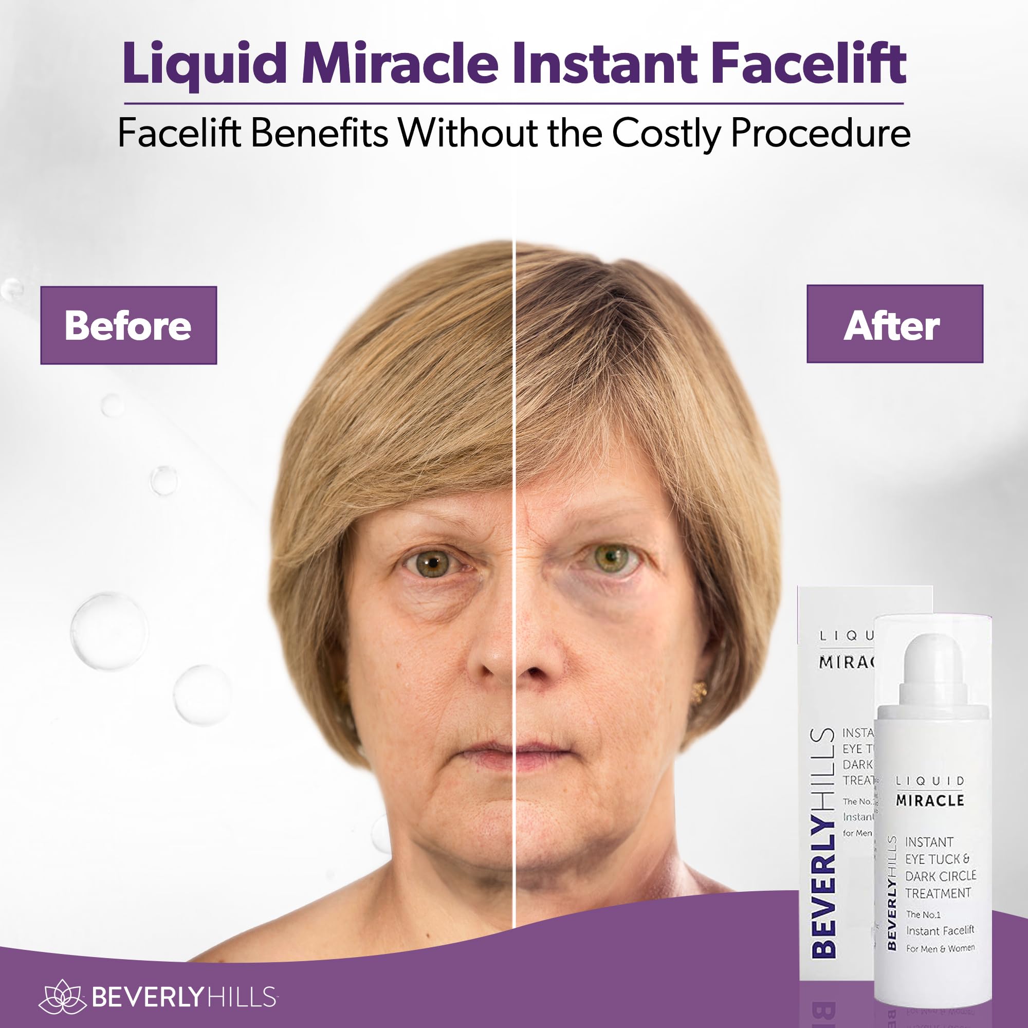 BEVERLY HILLS avant-après-serum-yeux, regard potentiellement plus détendu.