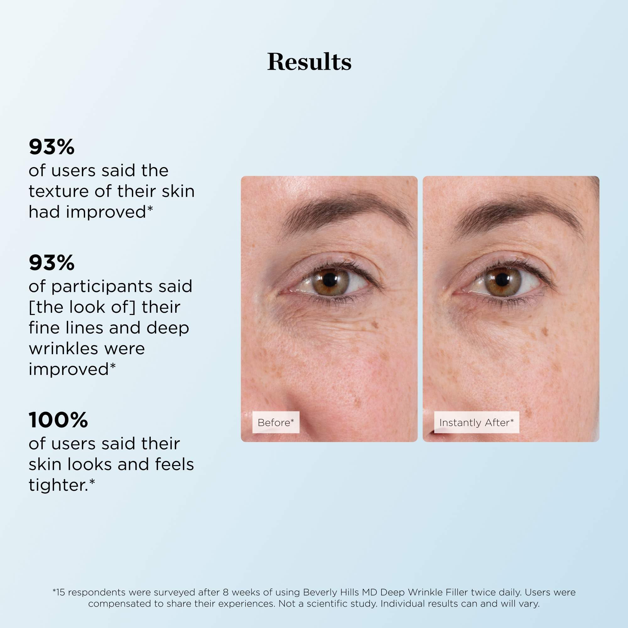 Beverly Hills MD polymères adaptés à la peau pour lisser la surface et remplir les creux