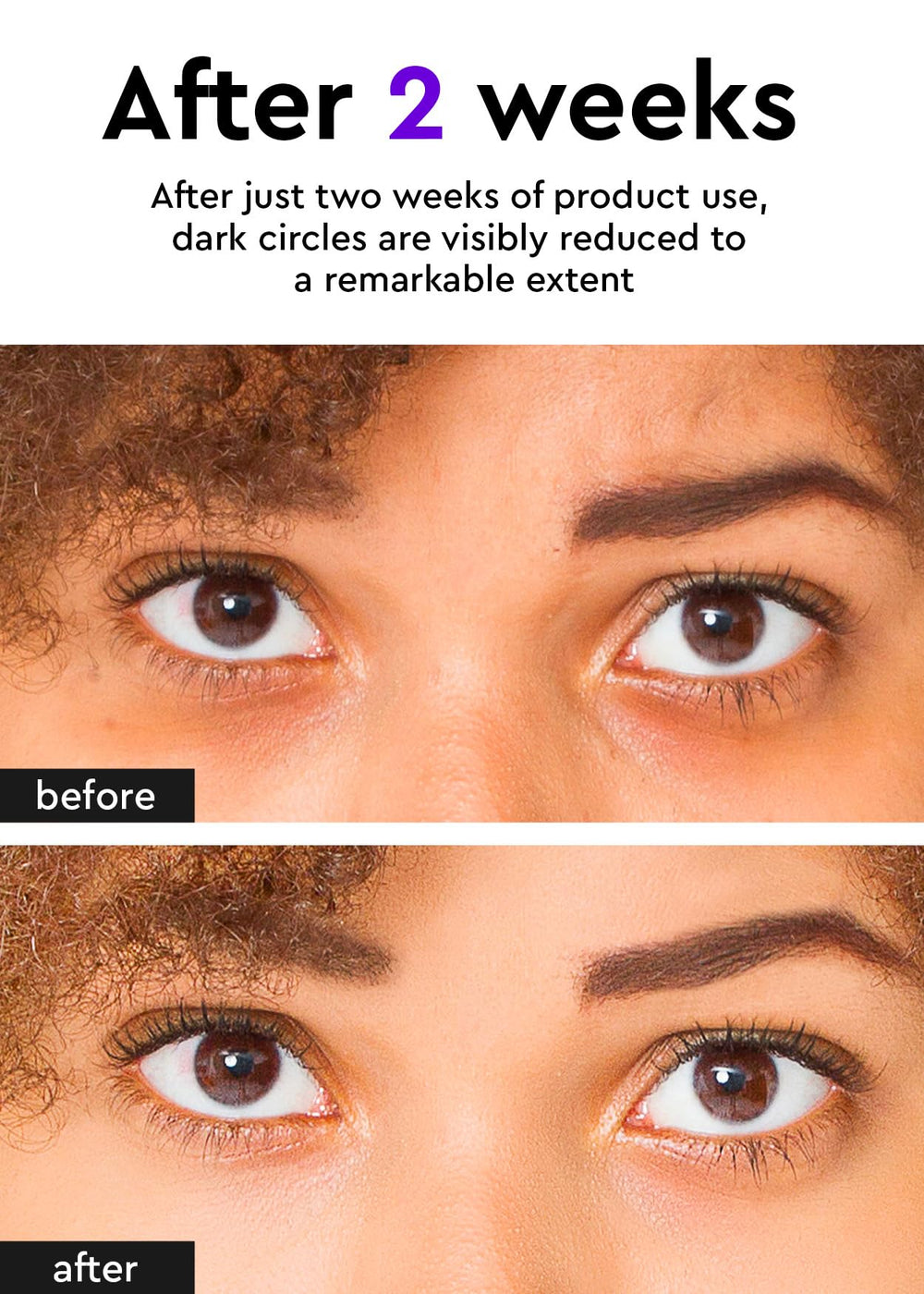 BE+WANTS crème yeux hypoallergenique - apaise les poches et irritations.