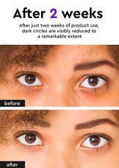 BE+WANTS crème yeux hypoallergenique - apaise les poches et irritations.
