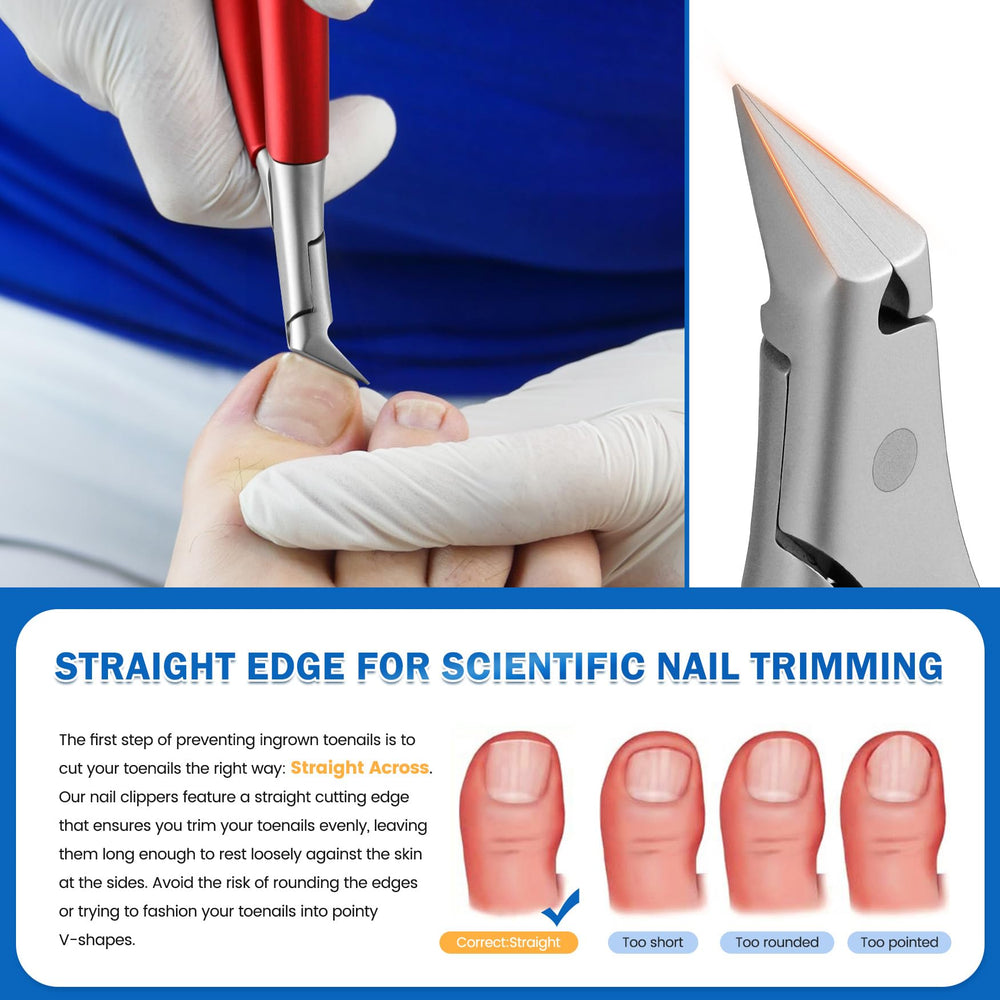 BEZOX coupe-ongles prévention-ongles-incurves: réduit le risque d’ongles incarnés.