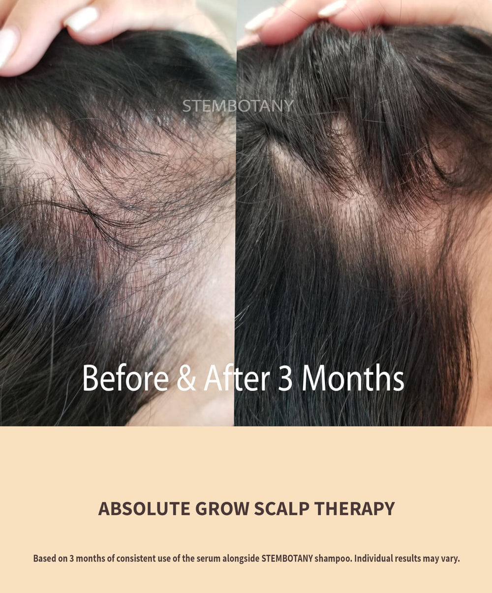 Goutte-serum-cheveux: application précise pour nourrir les racines.