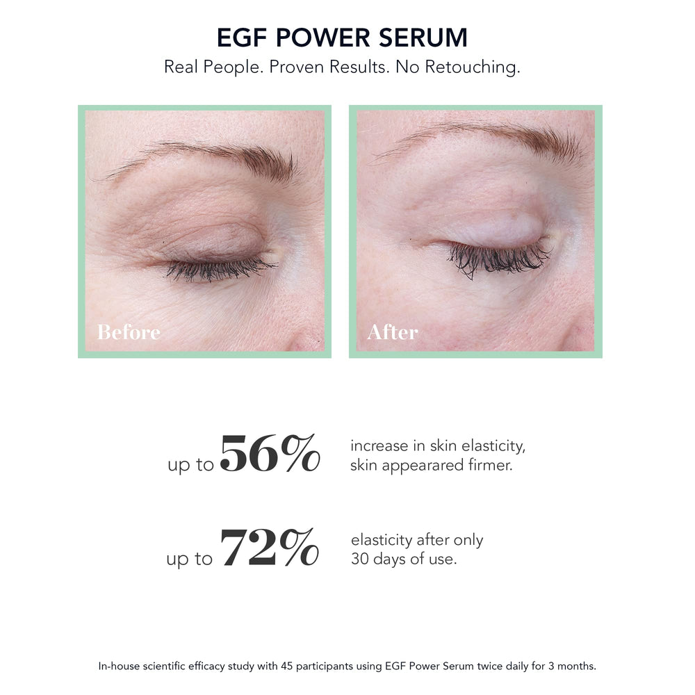 Bioeffect EGF Puissant Sérum – flacon NAG, potentiel soutien de l’élasticité et de l’éclat