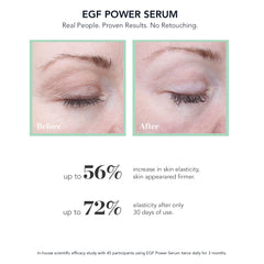 Bioeffect EGF Puissant Sérum – flacon NAG, potentiel soutien de l’élasticité et de l’éclat