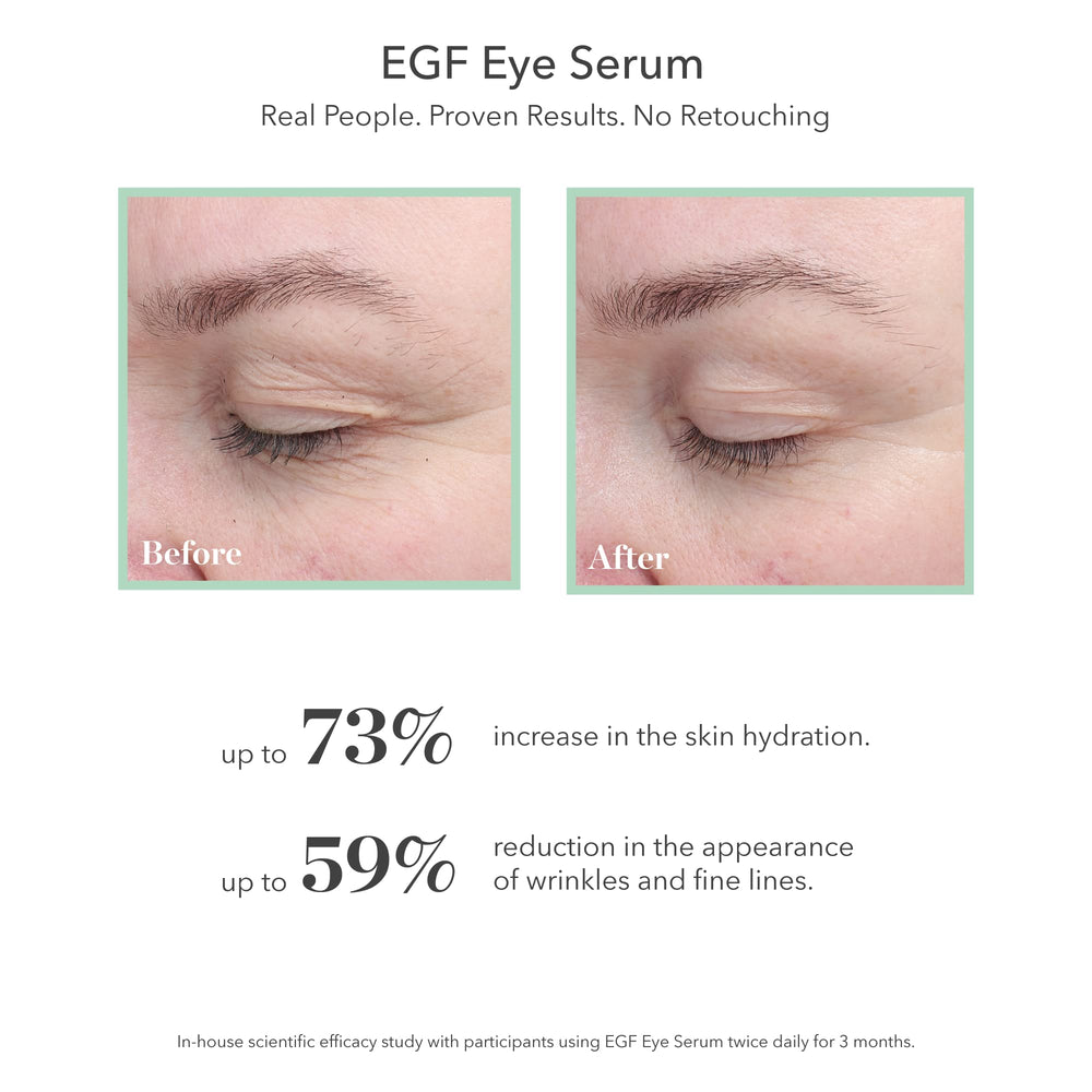 Flacon de 6 mL BIOEFFECT EGF prêt à hydrater le contour des yeux.
