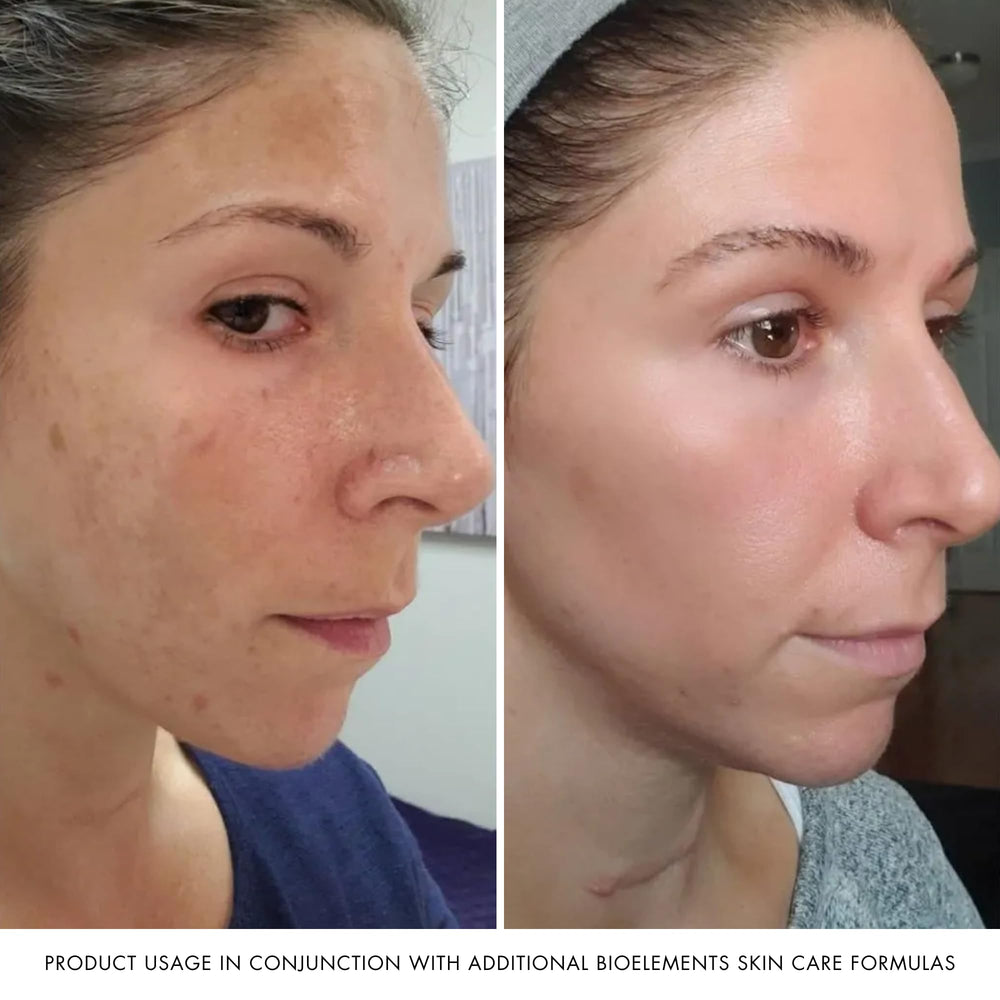Ingrédients clés Bioelements Absolute Moisture: avocat, amande et jojoba pour nourrir en douceur.