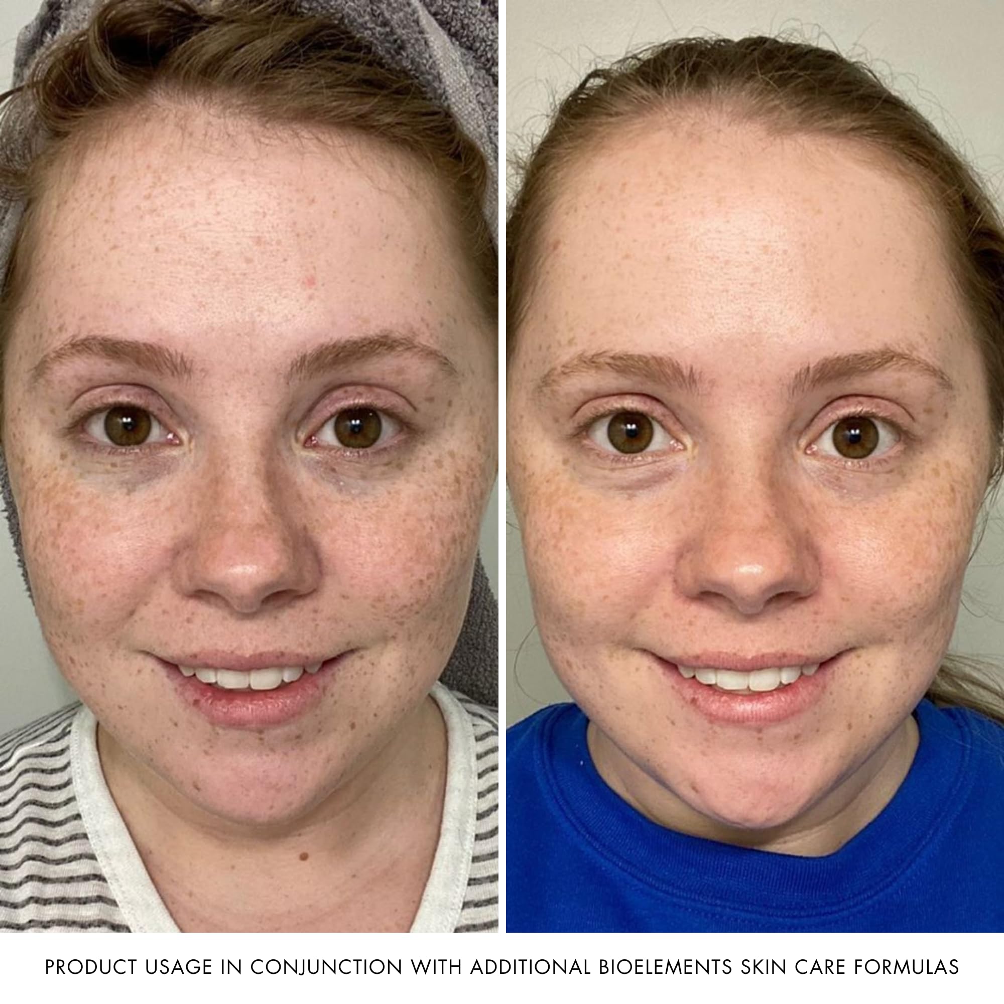 Bioelements Beyond Hydration — texture fraîche et hydratante sans lourdeur
