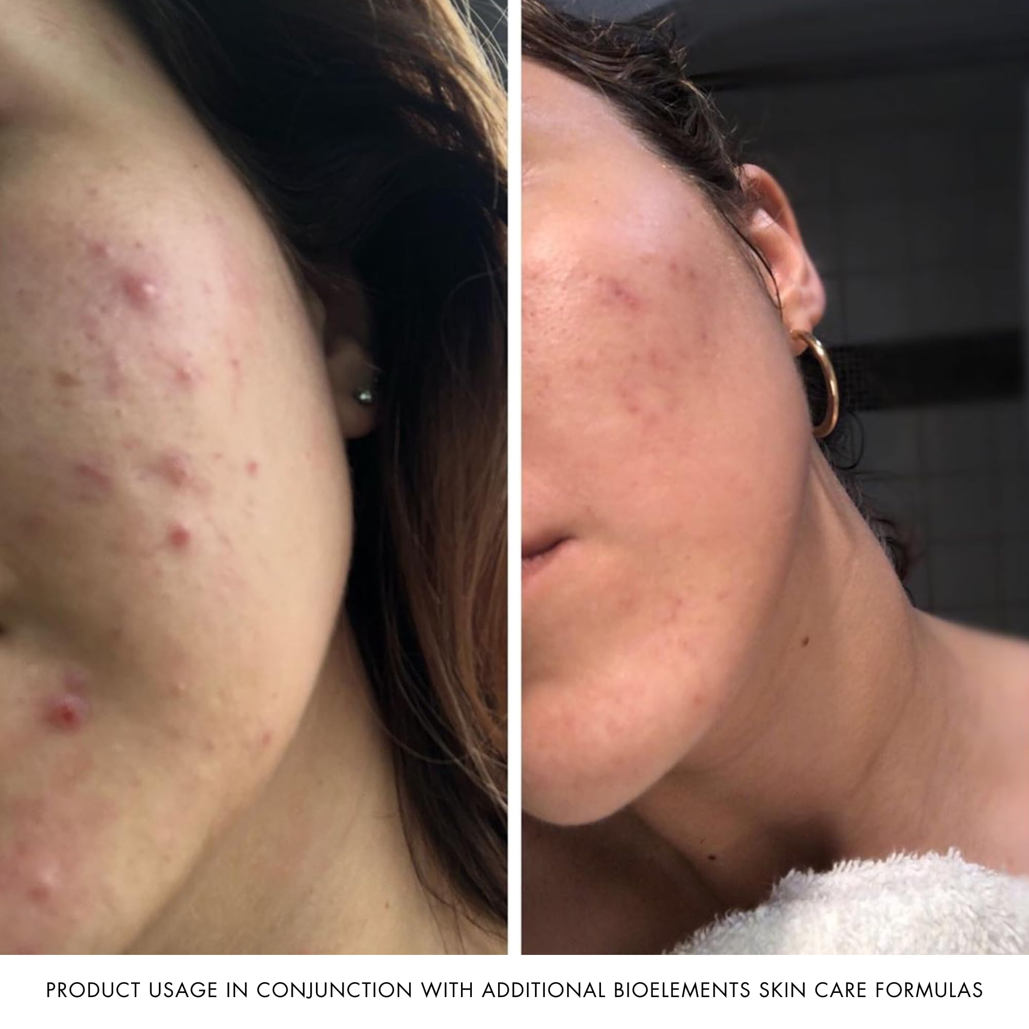 Bioelements Moisture Positive Cleanser — formulation à base d’herbes chinoises pour l’équilibre cutané.