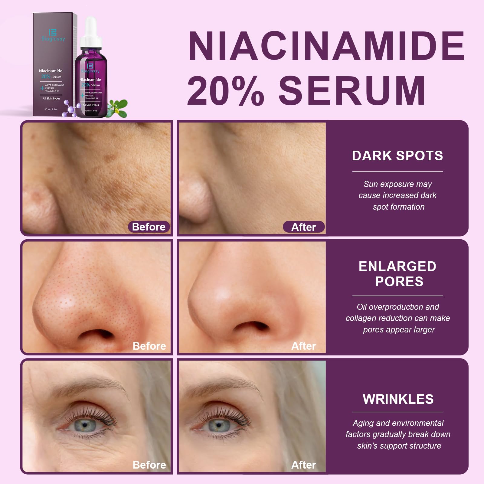 Acide hyaluronique intégré pour hydrater en profondeur avec Bioglossy.