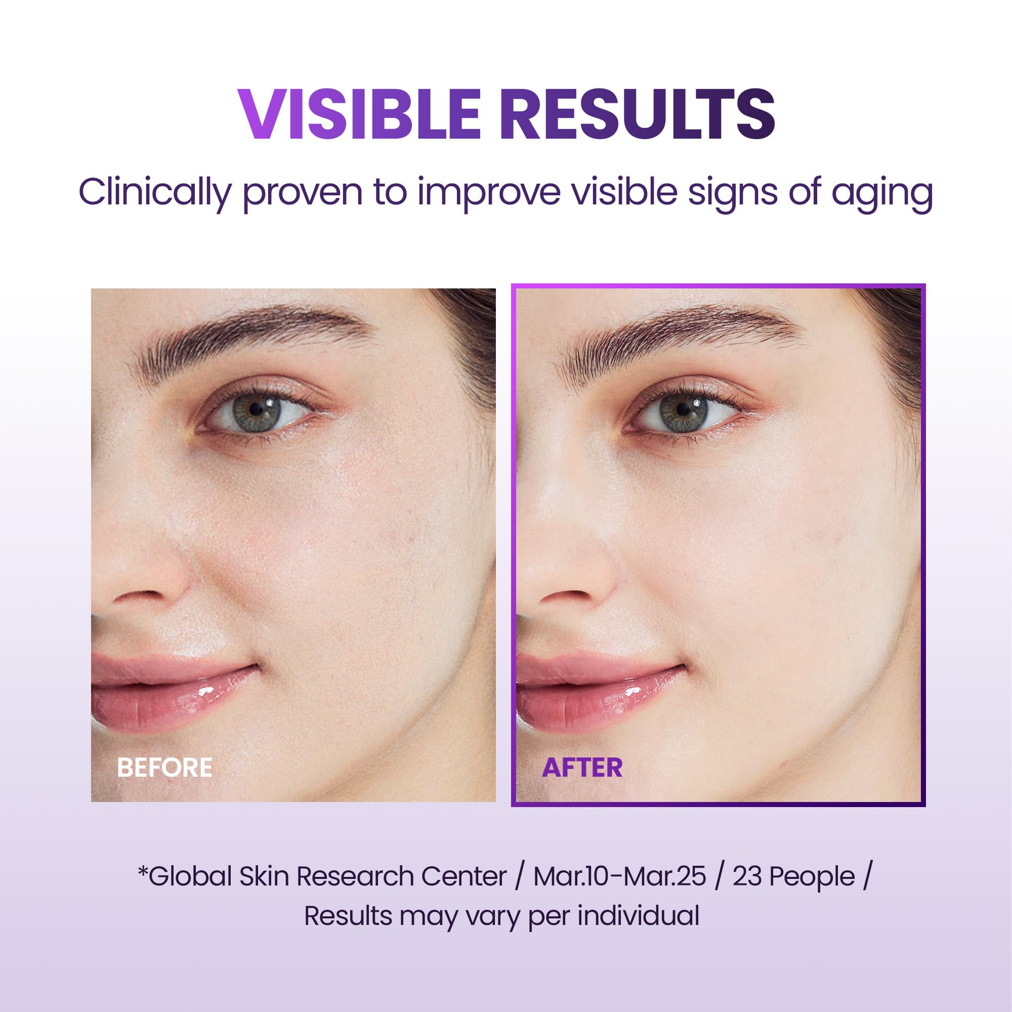 BIOHEAL BOH Probioderm 3D liftant complexe probiotiques pour l’élasticité.