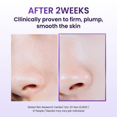 BIOHEAL BOH Probioderm Crème application rapide, absorption légère.