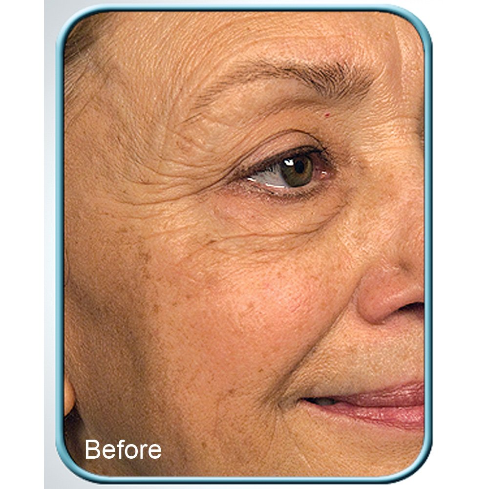 Biologic Solutions crème cellules souches, texture veloutée prête à l'application.