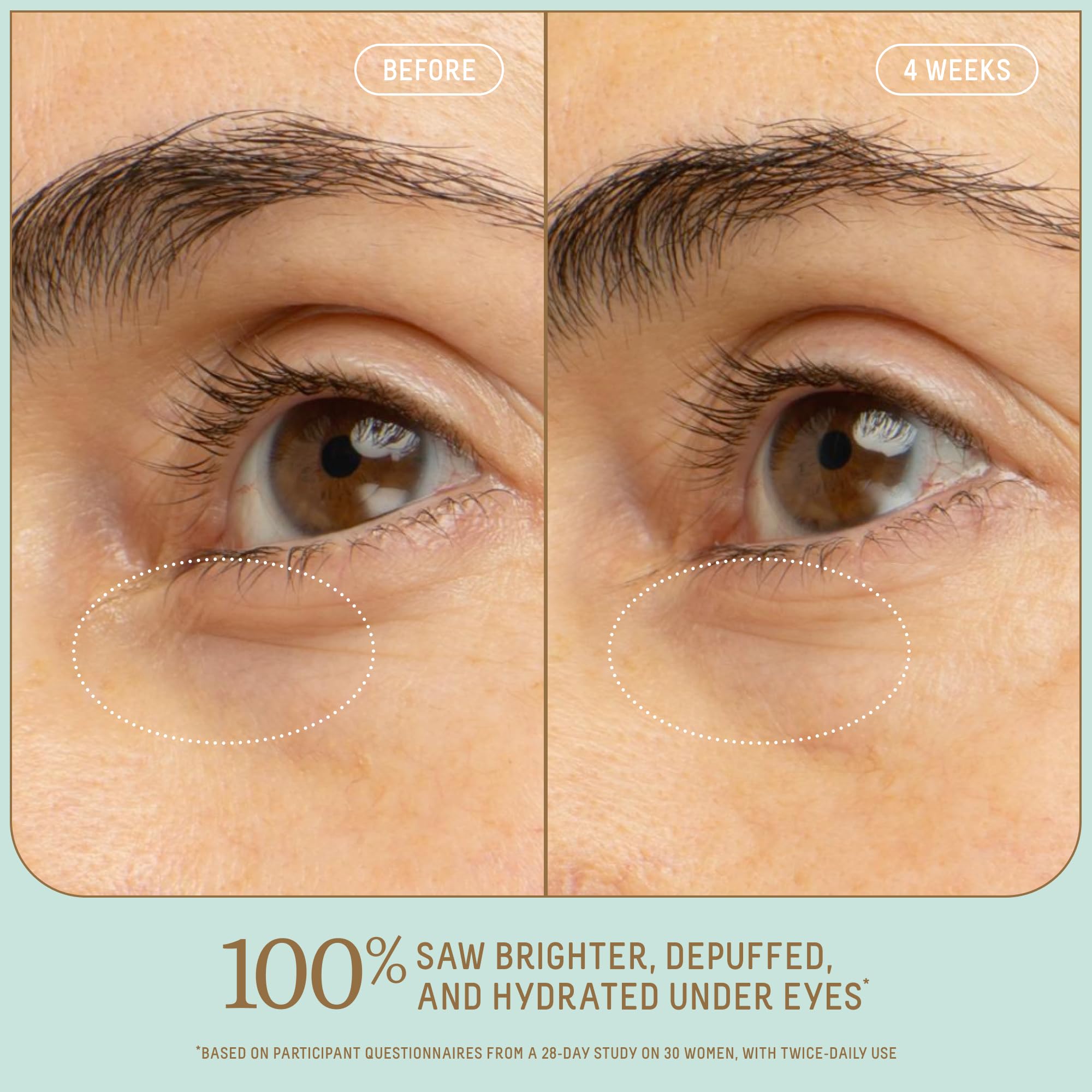 Regard plus lumineux grâce au sérum Biossance et à la niacinamide associée à la vitamine C.