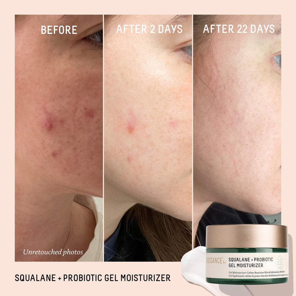Biossance Texture Gel Léger Peau: absorption rapide et confort.