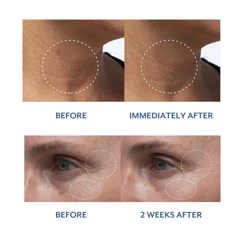 Bloomeffects Nectar Royal Tulip : emballage minimaliste et élégant pour votre routine beauté.