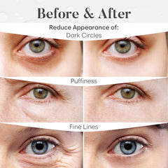 Patchs thé vert BLOOMORA, effet rafraîchissant autour des yeux.