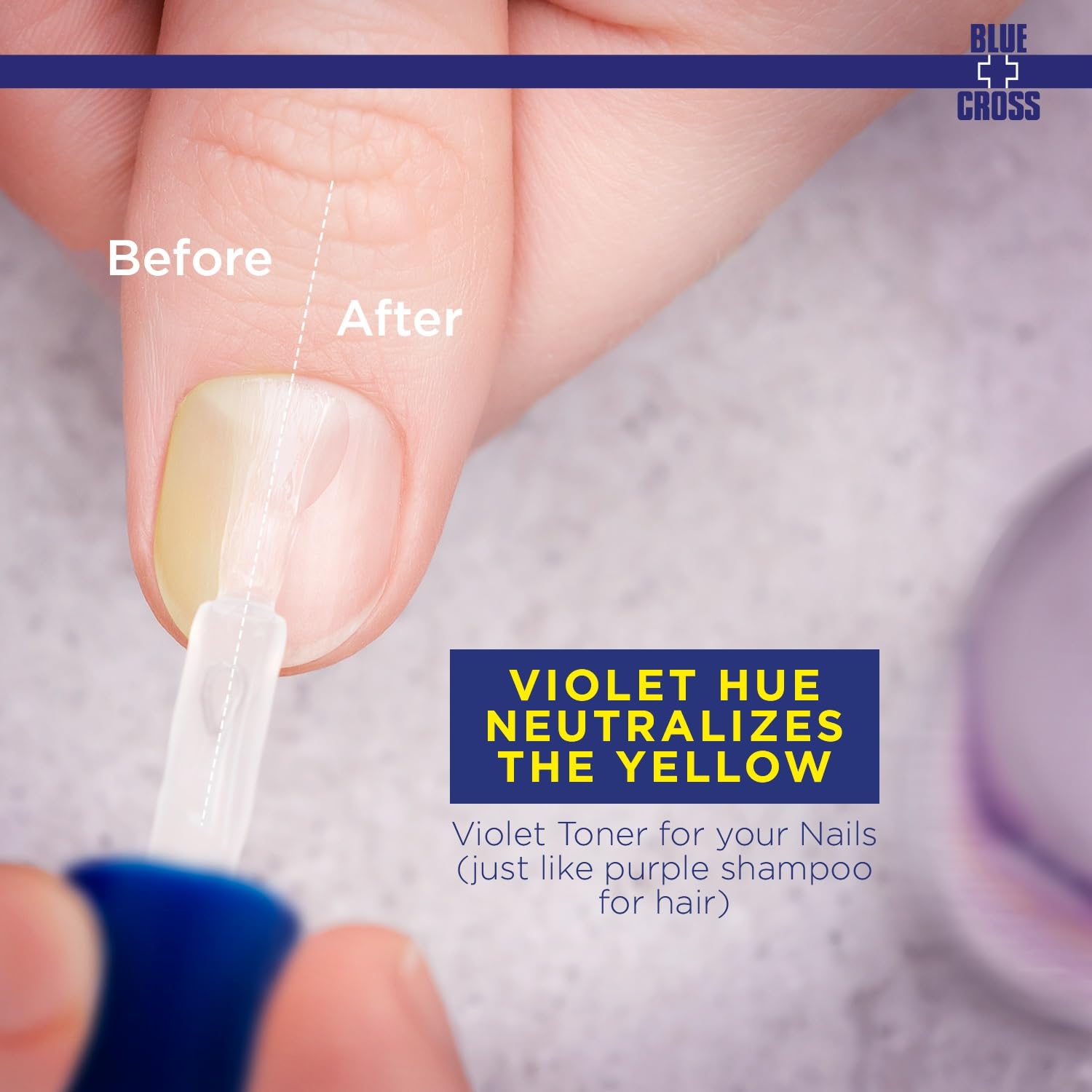 Blue Cross Yello Out - avant/après sur ongles jaunes.